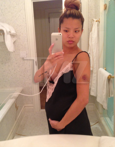 lydia-nam-the-dream-pregnant-injury-photos-016-480w