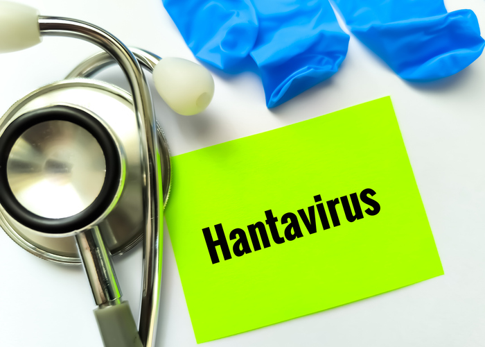 Term Hantavirus, epidemic, medical conceptual image.